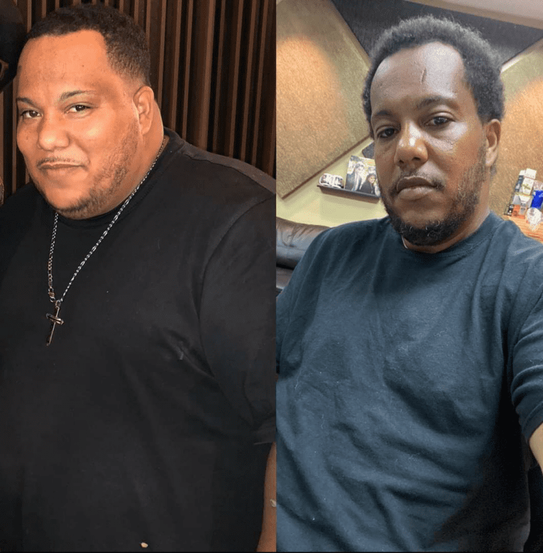 Anthony's Transformation